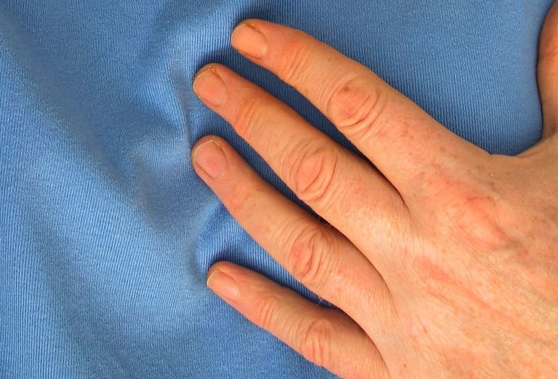 Aort yırtılması nedir, neden olur?